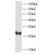 WB analysis of MCF-7 cells, using CSNK2B antibody (1/1000 dilution).