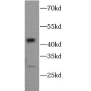 WB analysis of Jurkat cells, using CASP1 antibody (1/1000 dilution).