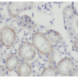 Caspase 2 (CASP2) Antibody