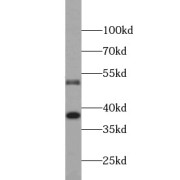 WB analysis of HepG2 cells, using CASP8 antibody (1/1000 dilution).