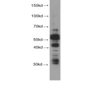 WB analysis of HepG2 cells, using CASP8 antibody (1/1000 dilution).