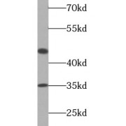 WB analysis of HeLa cells, using Caspase 9 antibody (1/1000 dilution).