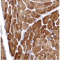 Calsequestrin 2 (CASQ2) Antibody