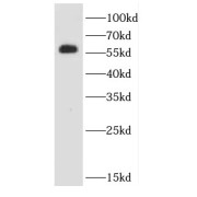 WB analysis of human heart tissue, using CASQ2 antibody (1/500 dilution).