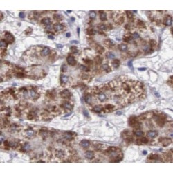 Catalase (CAT) Antibody