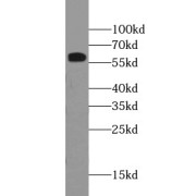 WB analysis of HeLa cells, using CAT antibody (1/1000 dilution).