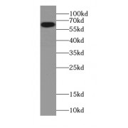 WB analysis of HT-1080 cells, using CAT-Specific antibody (1/1000 dilution).