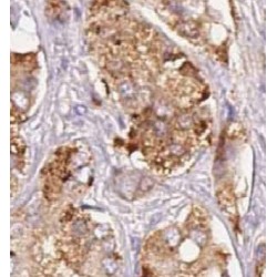 Cathepsin F (CTSF) Antibody