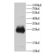 WB analysis of mouse brain tissue, using CBLN2 antibody (1/800 dilution).