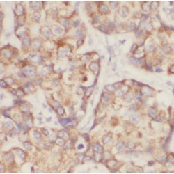 CBP,EIF4E Antibody