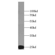 WB analysis of HEK-293 cells, using EIF4E antibody (1/1000 dilution).