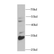 WB analysis of HeLa cells, using CBR3 antibody (1/1000 dilution).