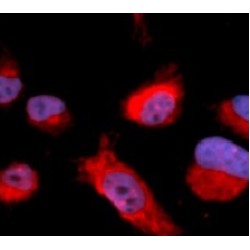 Cystathionine-Beta-Synthase (CBS) Antibody