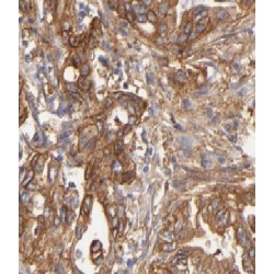 Cystathionine-Beta-Synthase (CBS) Antibody