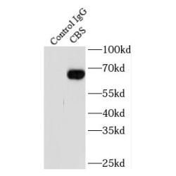 Cystathionine-Beta-Synthase (CBS) Antibody