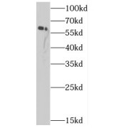 WB analysis of mouse kidney tissue, using CBS antibody (1/500 dilution).