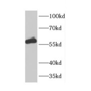 WB analysis of HEK-293 cells, using CBX2 antibody (1/500 dilution).