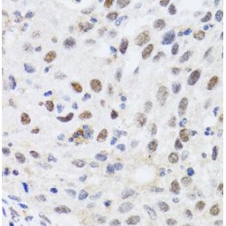 E3 SUMO-Protein Ligase CBX4 (CBX4) Antibody