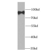 WB analysis of Jurkat cells, using CBX4 antibody (1/1000 dilution).