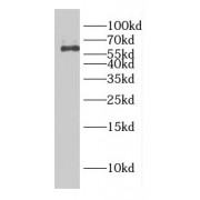 WB analysis of HepG2 cells, using CBX6 antibody (1/1000 dilution).