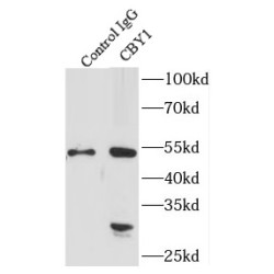 Chibby Homolog 1 (Drosophila) (CBY1) Antibody