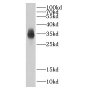 WB analysis of mouse liver tissue, using CBY1 antibody (1/500 dilution).