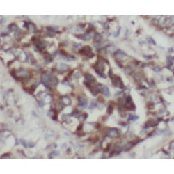 Coiled Coil And C2 Domain Containing 2A (CC2D2A) Antibody