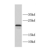 WB analysis of HeLa cells, using CCDC12 antibody (1/600 dilution).