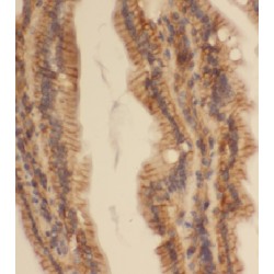 Coiled-Coil Domain Containing 120 (CCDC120) Antibody