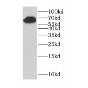 WB analysis of Jurkat cells, using CCDC120 antibody (1/500 dilution).