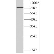 WB analysis of human brain tissue, using CCDC22 antibody (1/500 dilution).