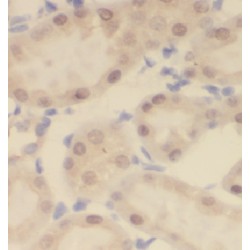 Coiled-Coil Domain Containing 25 (CCDC25) Antibody