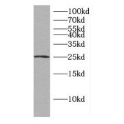 WB analysis of HeLa cells, using CCDC25 antibody (1/500 dilution).