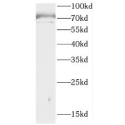 WB analysis of A375 cells, using CCDC28A antibody (1/300 dilution).