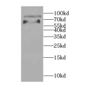 WB analysis of HEK-293 cells, using CCDC41 antibody (1/600 dilution).