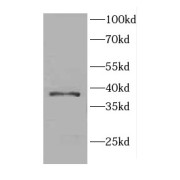 WB analysis of human testis tissue, using CCDC42 antibody (1/500 dilution).