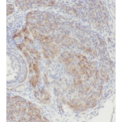 Coiled-Coil Domain Containing 51 (CCDC51) Antibody