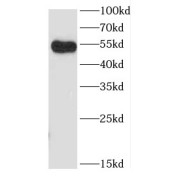 WB analysis of Jurkat cells, using CCDC83 antibody (1/600 dilution).