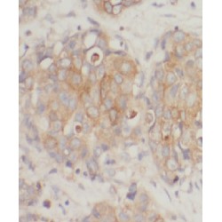 Coiled-Coil Domain-Containing Protein 99 (CCDC99) Antibody