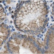 IHC-P analysis of human stomach tissue, using CCKAR-specific Antibody (1/50 dilution).