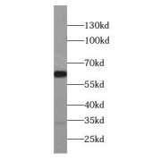 WB analysis of BxPC-3 cells, using CCKBR-specific antibody (1/500 dilution).