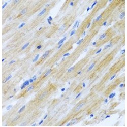 C-C Motif Chemokine 17 (CCL17) Antibody