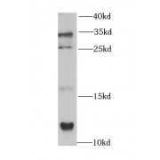 WB analysis of Transfected HEK-293 cells, using CCL17 antibody (1/1000 dilution).