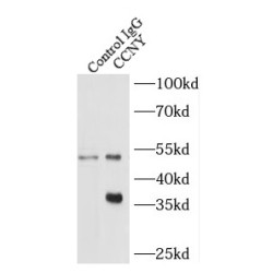 Cyclin Y (CCNY) Antibody