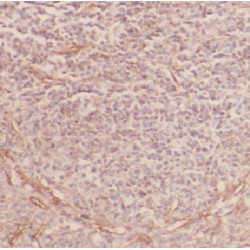 Chemokine C-C-Motif Receptor 10 (CCR10) Antibody