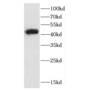 WB analysis of mouse brain tissue, using CCR10 antibody (1/1000 dilution).