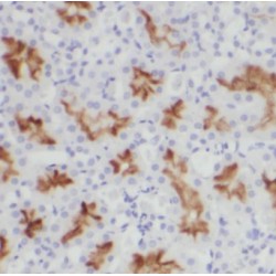 CCR2-specific Antibody