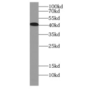 WB analysis of Jurkat cells, using CCR2a-specific antibody (1/200 dilution).