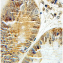 Chaperonin Containing TCP1, Subunit 3 (CCT3) Antibody