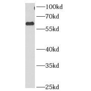 WB analysis of COLO 320 cells, using CCT3 antibody (1/1000 dilution).